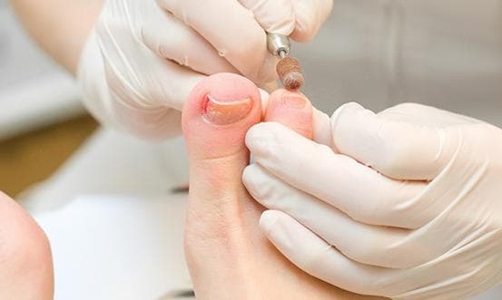 Appareillages de podologie
